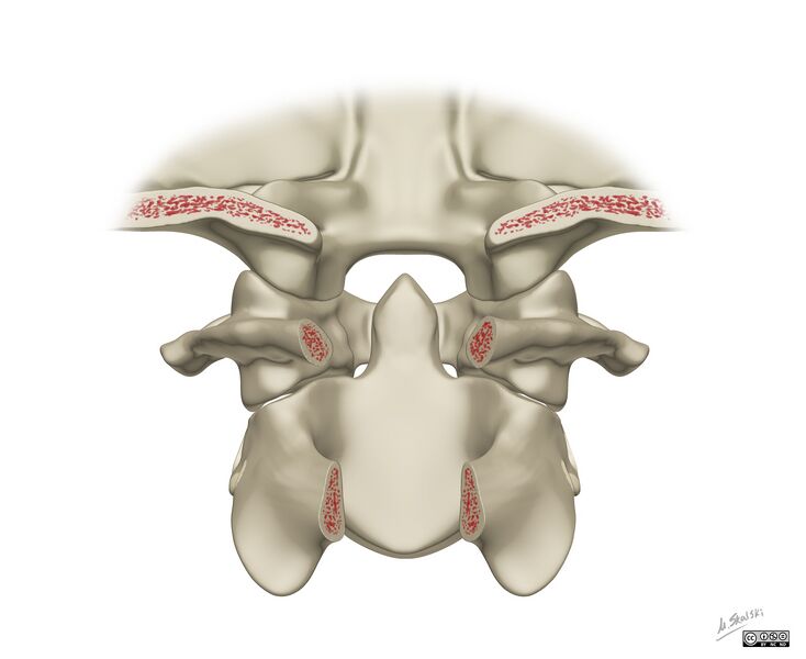 File:Alar and cruciform ligament anatomy (Radiopaedia 45136-49117 C 1).jpg