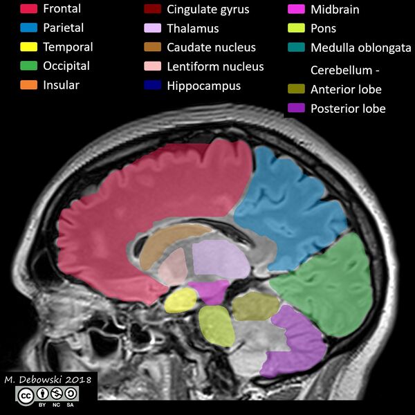 File:Brain lobes - annotated MRI (Radiopaedia 61691-69700 Sagittal 47).JPG