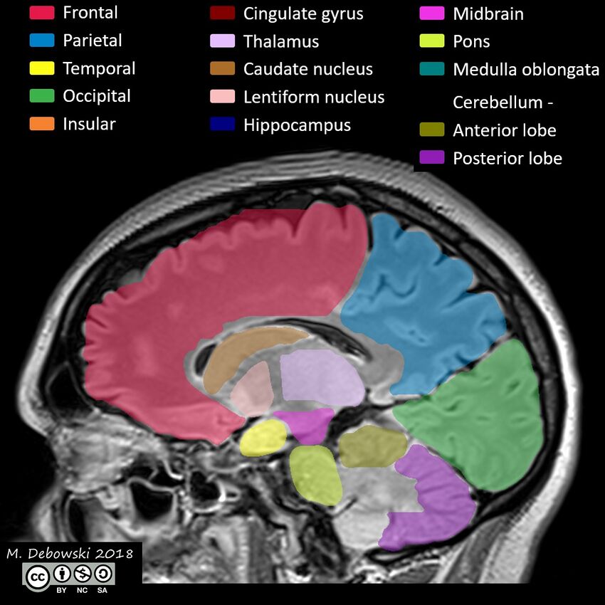 Brain lobes - annotated MRI (Radiopaedia 61691-69700 Sagittal 47).JPG