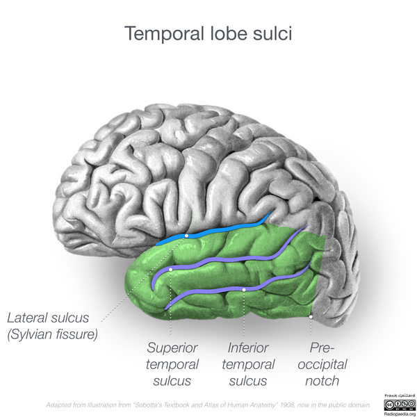 File:Neuroanatomy- lateral cortex (diagrams) (Radiopaedia 46670-51201 Temporal lobe 1).png