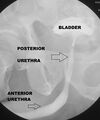 Normal urethra (Radiopaedia 30340-30986 B 1).jpg