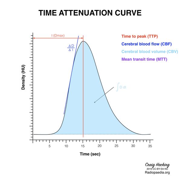 File:Brain perfusion - time attenuation curves (Radiopaedia 70313-80395 Parameters 1).jpeg