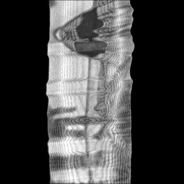 File:Normal CT angiogram of pelvis (Radiopaedia 45390-49430 B 51).jpg