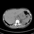 Normal multiphase CT liver (Radiopaedia 38026-39996 Axial non-contrast 15).jpg