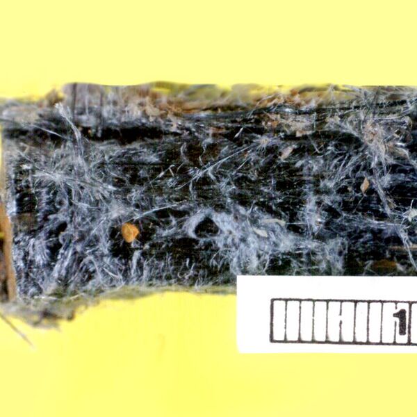File:Asbestos - crocidolite (photo) (Radiopaedia 8732).jpg