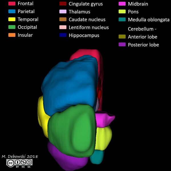File:Brain lobes - annotated MRI (Radiopaedia 61691-69700 3D reconstruction 65).JPG