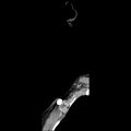 Normal CT of the neck (Radiopaedia 14575-14500 Sagittal C+ 2).jpg