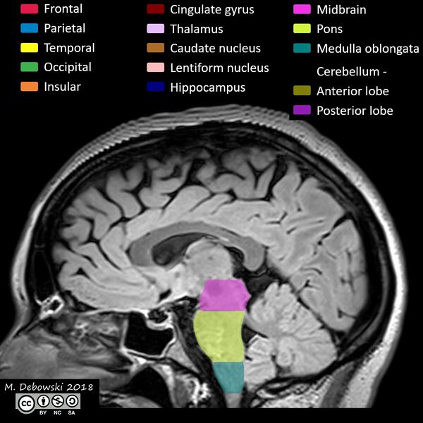 File:Brain lobes - annotated MRI (Radiopaedia 61691-69700 Sagittal 37).JPG