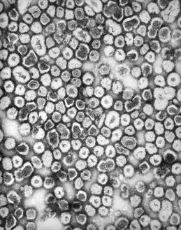 TEM image of La Crosse encephalitis virus ribonucleoprotein particles