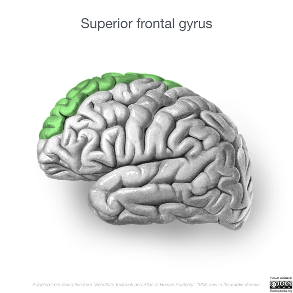 File:Neuroanatomy- lateral cortex (diagrams) (Radiopaedia 46670-51313 D 3).png