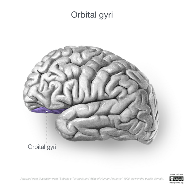 File:Neuroanatomy- lateral cortex (diagrams) (Radiopaedia 46670-51313 Orbital gyri 1).png
