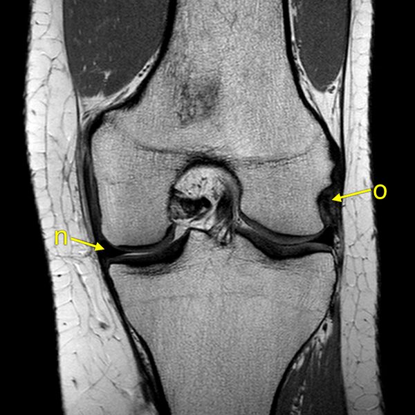 File:Anatomy Quiz (MRI knee) (Radiopaedia 43478-46874 A 17).jpeg