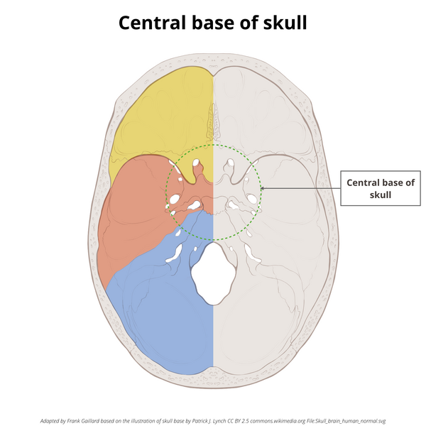 File:Base of skull (illustrations) (Radiopaedia 59251-66592 B 9).png