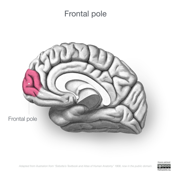 File:Neuroanatomy- medial cortex (diagrams) (Radiopaedia 47208-52697 Frontal pole 1).png