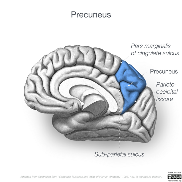 File:Neuroanatomy- medial cortex (diagrams) (Radiopaedia 47208-52697 Precuneus 3).png