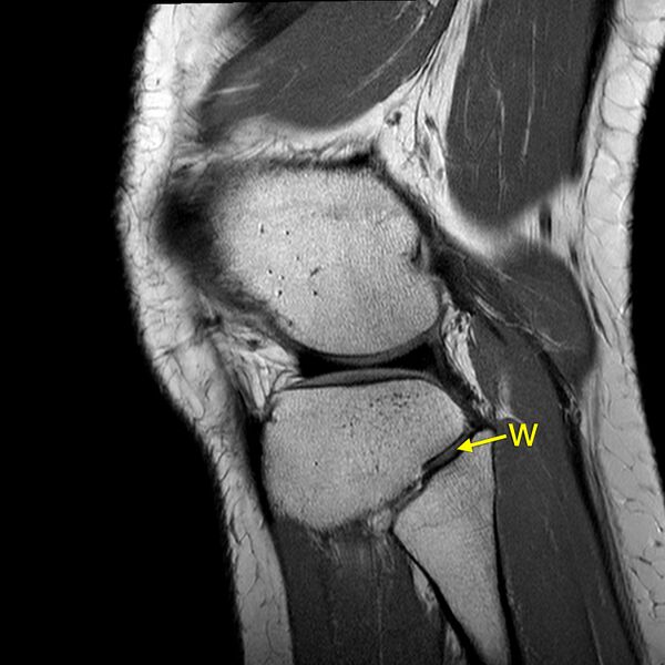 File:Anatomy Quiz (MRI knee) (Radiopaedia 43478-46865 A 22).jpeg