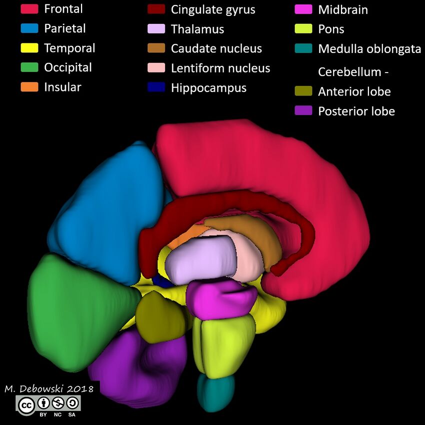 Brain lobes - annotated MRI (Radiopaedia 61691-69700 3D reconstruction 80).JPG