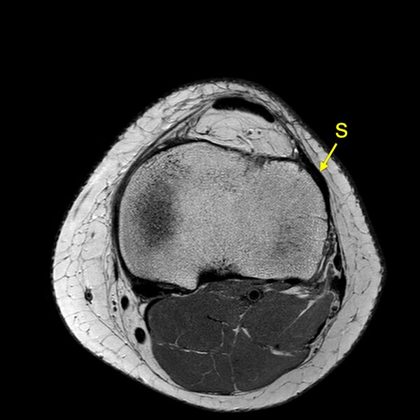 File:Anatomy Quiz (MRI knee) (Radiopaedia 43478-46866 A 20).jpeg