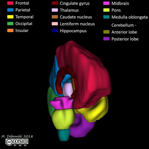 File:Brain lobes - annotated MRI (Radiopaedia 61691-69700 3D reconstruction 14).JPG