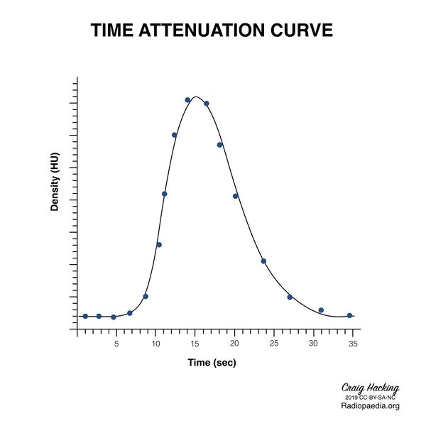 File:Brain perfusion - time attenuation curves (Radiopaedia 70313-80395 Curve generation 18).jpeg