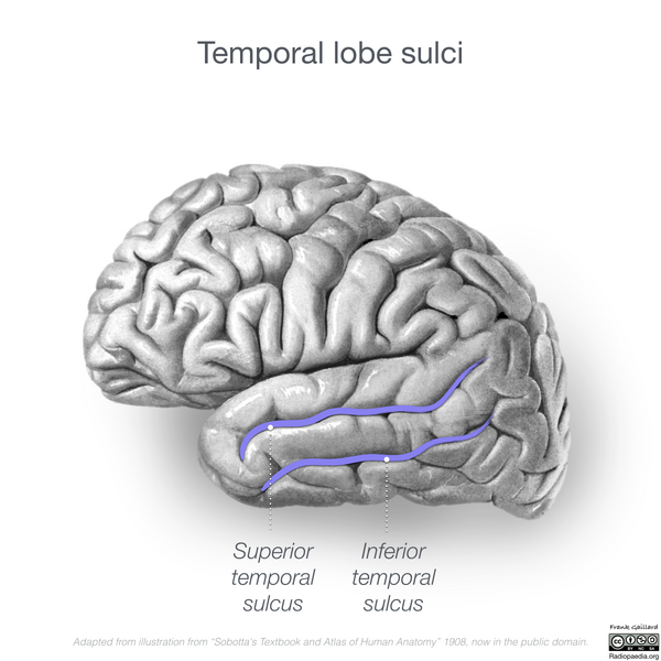 File:Neuroanatomy- lateral cortex (diagrams) (Radiopaedia 46670-51201 G 2).png