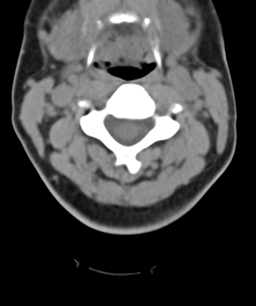 File:Normal cervical spine MRI (including Dixon) (Radiopaedia 42762-45926 Axial non-contrast 24).png
