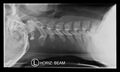 Normal cervical spine trauma radiographs (age 14) (Radiopaedia 45337-49360 Lateral 1).jpg