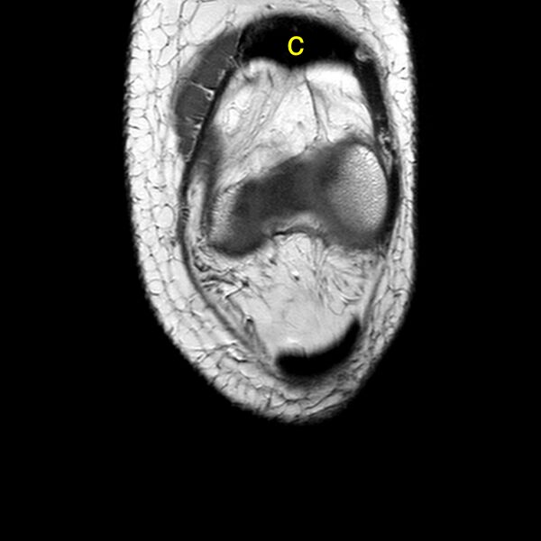 File:Anatomy Quiz (MRI knee) (Radiopaedia 43478-46874 A 4).jpeg