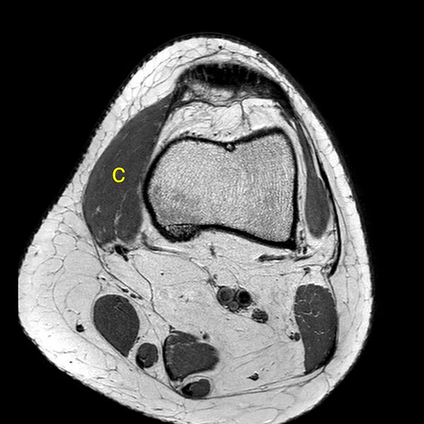 File:Anatomy Quiz (MRI knee) (Radiopaedia 43478-46866 A 4).jpeg