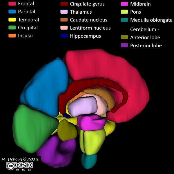 File:Brain lobes - annotated MRI (Radiopaedia 61691-69700 3D reconstruction 79).JPG