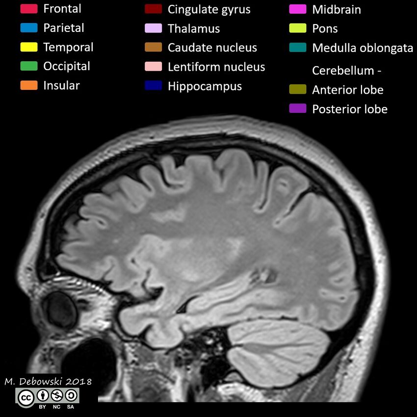 Brain lobes - annotated MRI (Radiopaedia 61691-69700 Sagittal 21).JPG