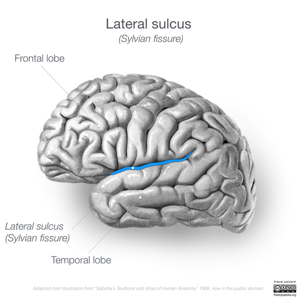 File:Neuroanatomy- lateral cortex (diagrams) (Radiopaedia 46670-51202 Lateral sulcus 5).png