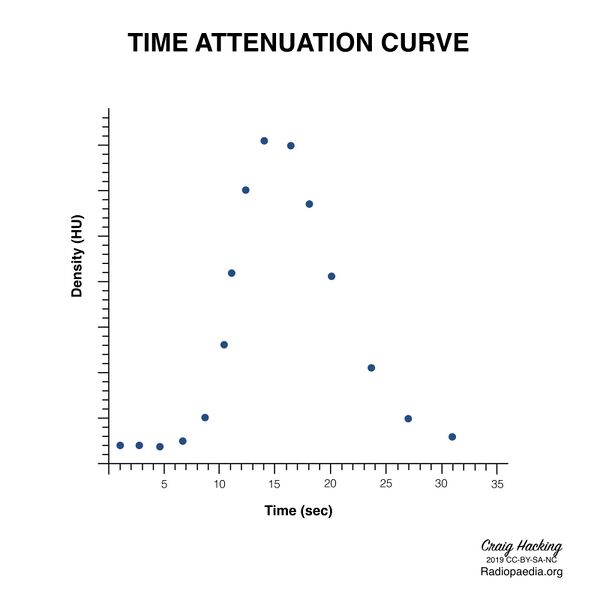 File:Brain perfusion - time attenuation curves (Radiopaedia 70313-80395 Curve generation 16).jpeg