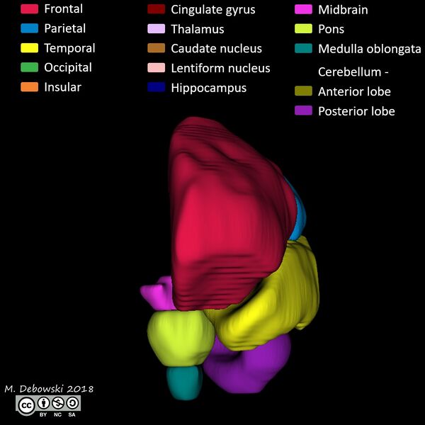 File:Brain lobes - annotated MRI (Radiopaedia 61691-69700 3D reconstruction 19).JPG