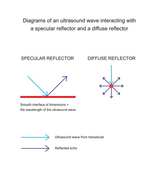 File:Diagrams of an ultrasound wave interacting with a specular reflector and a diffuse reflector (Radiopaedia 46465).jpg