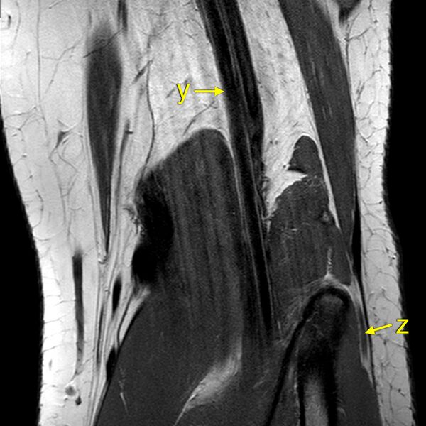 File:Anatomy Quiz (MRI knee) (Radiopaedia 43478-46874 A 26).jpeg