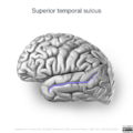 Neuroanatomy- lateral cortex (diagrams) (Radiopaedia 46670-51202 K 2).png