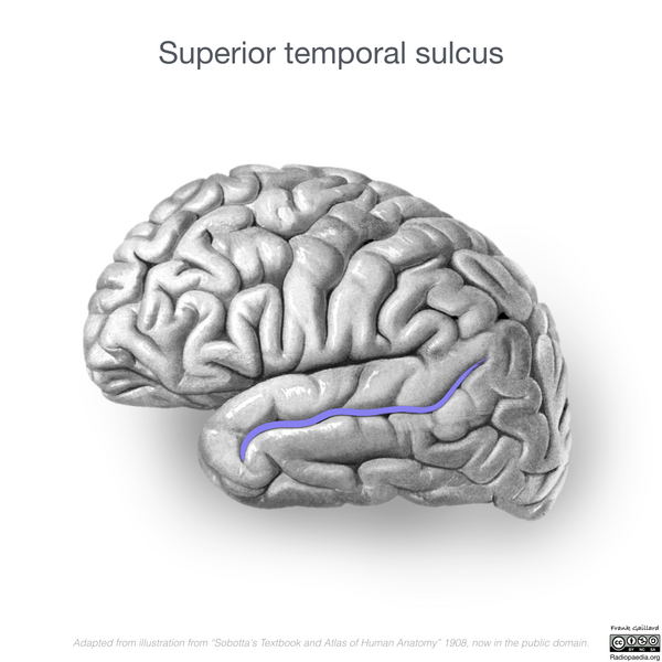 File:Neuroanatomy- lateral cortex (diagrams) (Radiopaedia 46670-51202 K 2).png
