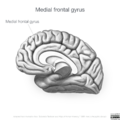 Neuroanatomy- medial cortex (diagrams) (Radiopaedia 47208-52697 Medial frontal gyrus 5).png
