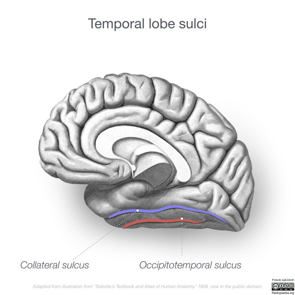 File:Neuroanatomy- medial cortex (diagrams) (Radiopaedia 47208-58969 I 1).png