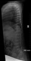 Normal skeletal survey - 5-month-old (Radiopaedia 53220-59186 B 1).jpg