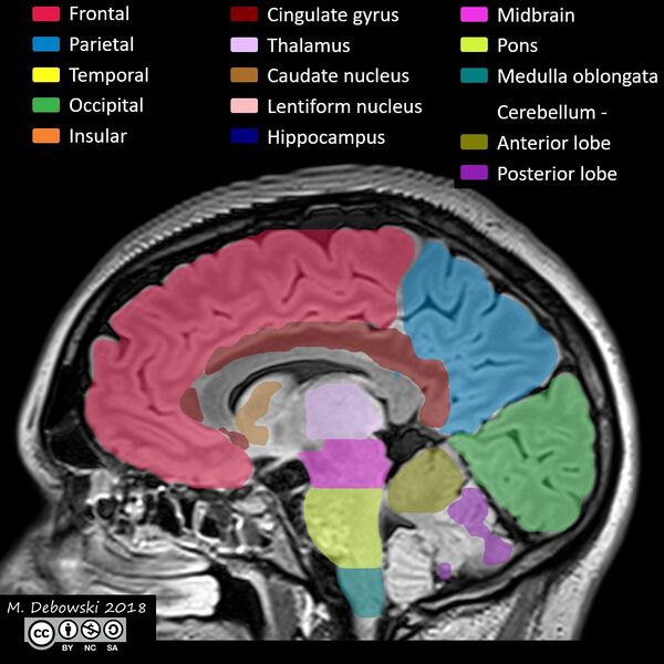 File:Brain lobes - annotated MRI (Radiopaedia 61691-69700 Sagittal 43).JPG