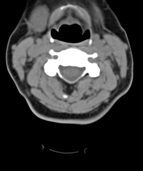 File:Normal cervical spine MRI (including Dixon) (Radiopaedia 42762-45926 Axial non-contrast 27).png