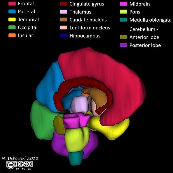 File:Brain lobes - annotated MRI (Radiopaedia 61691-69700 3D reconstruction 7).JPG