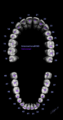 Dental notations (illustration) (Radiopaedia 73643).png