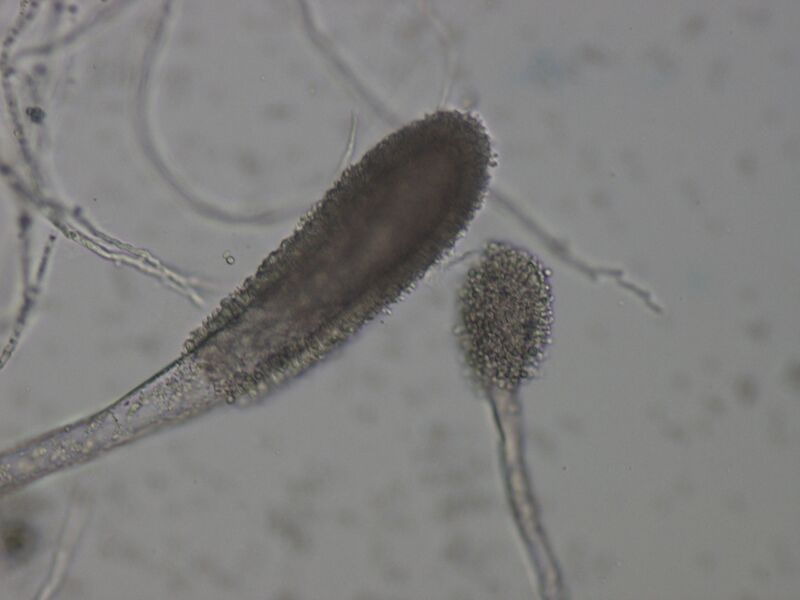 File:Aspergillus clavatus (microscopy) (Radiopaedia 13558).jpg