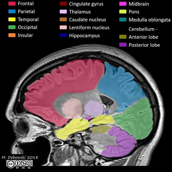 File:Brain lobes - annotated MRI (Radiopaedia 61691-69700 Sagittal 51).JPG