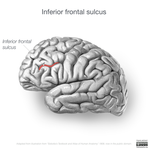 File:Neuroanatomy- lateral cortex (diagrams) (Radiopaedia 46670-51202 B 1).png