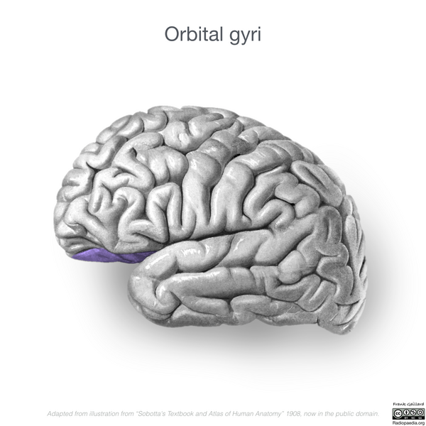 File:Neuroanatomy- lateral cortex (diagrams) (Radiopaedia 46670-51313 Orbital gyri 3).png