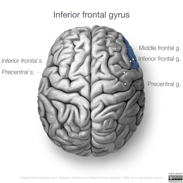 File:Neuroanatomy- superior cortex (diagrams) (Radiopaedia 59317-66670 D 1).png